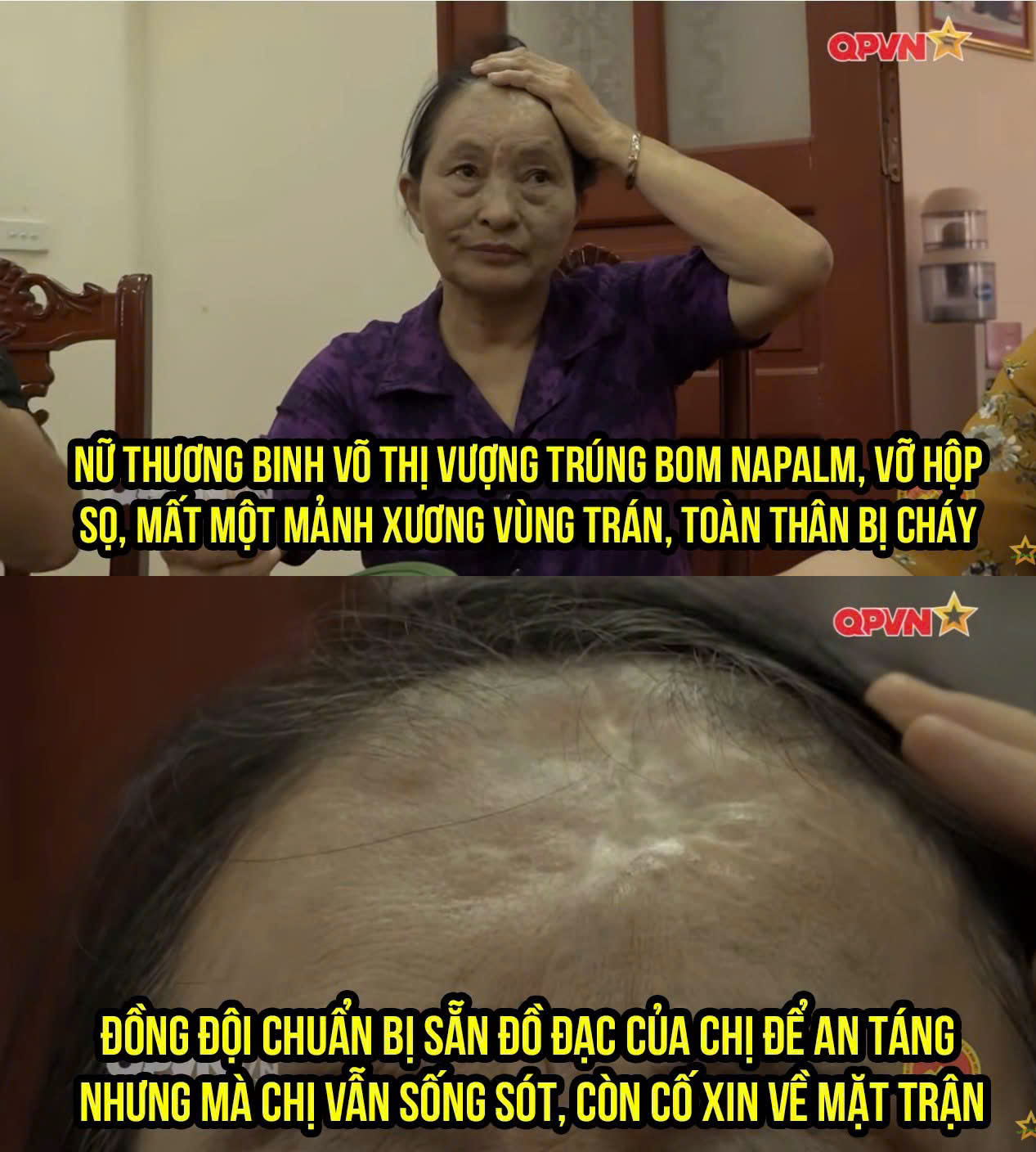 Nữ thương binh Võ Thị Vượng