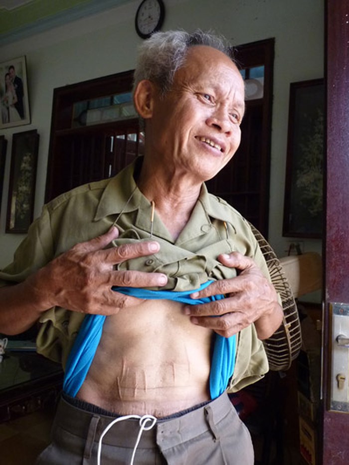 Ký ức của người tù cách mạng rạch bụng đòi tự do