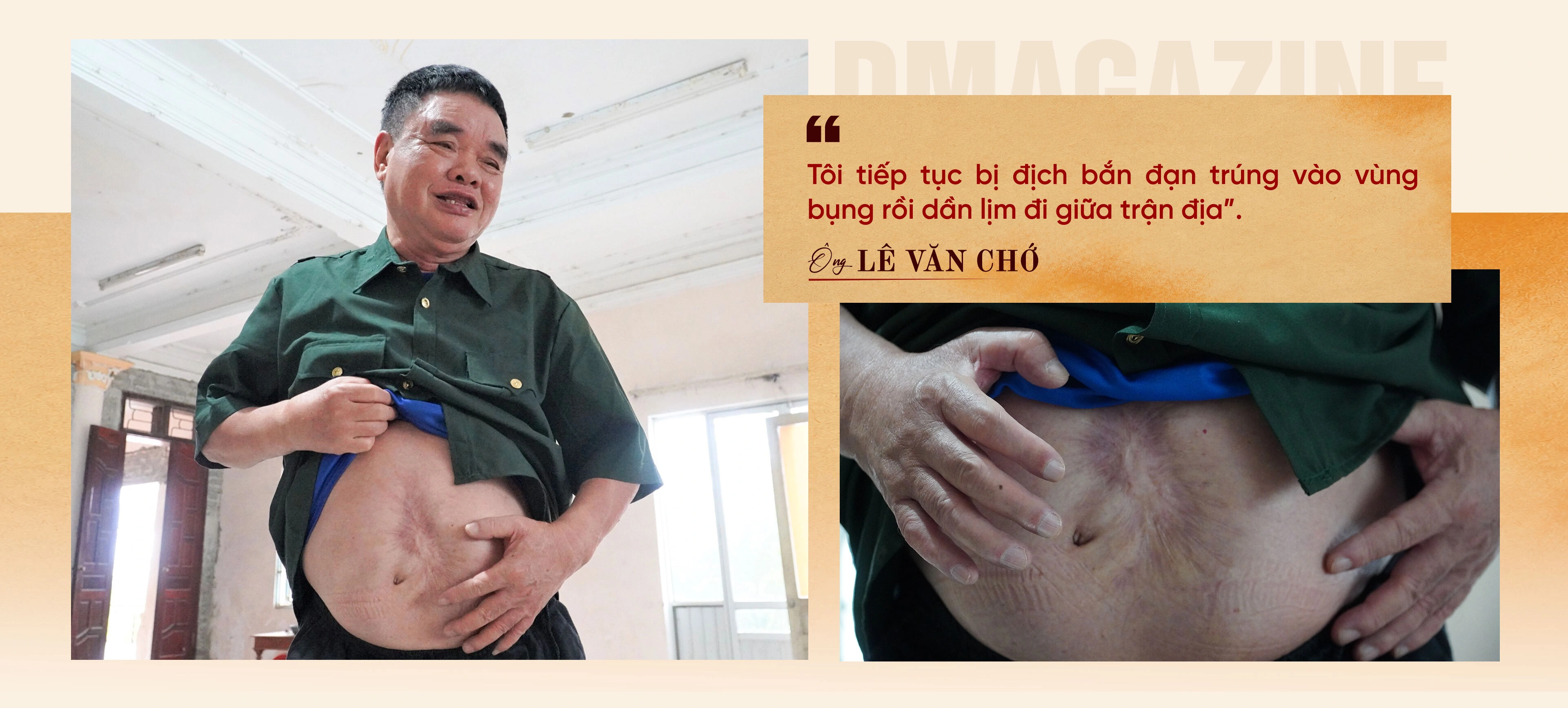 Bị bắn xuyên bụng vẫn sống sót kỳ diệu